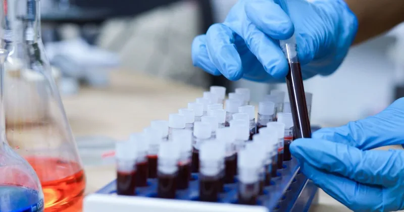Equipamento de laboratório realizando análise de amostra de sangue para diagnóstico médico.