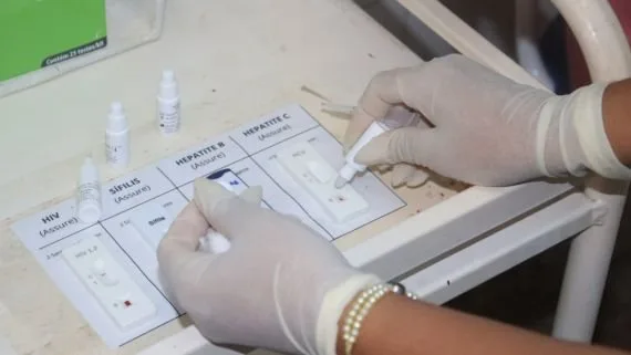 Profissional de saúde realizando exame de testagem rápida para ISTs.